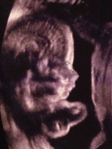 L'annonce de grossesse de Chris et NJ 