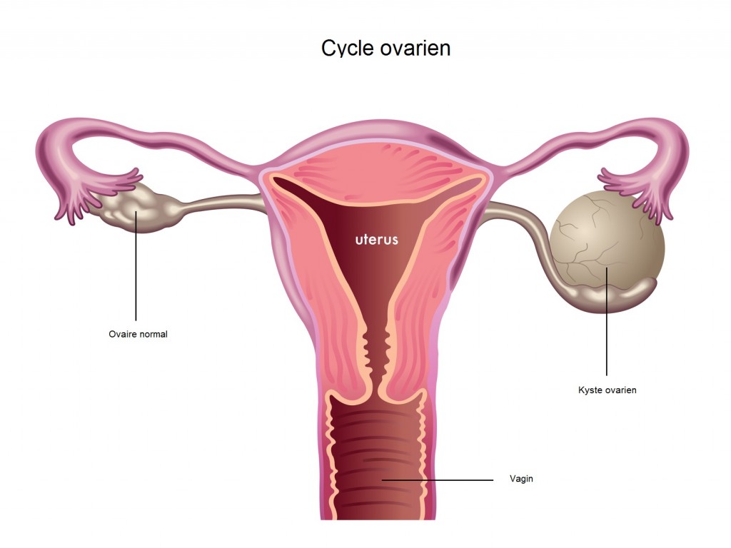 kyste-femme-grossesse-neuf-mois