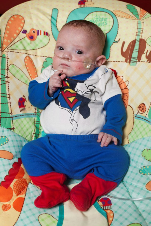 Bebe-premature-Superman-2