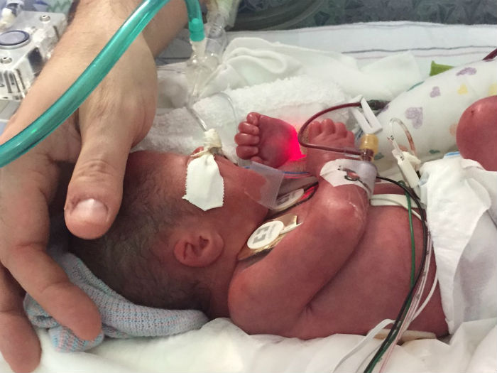 Bebe-premature-papa-chanteur-1