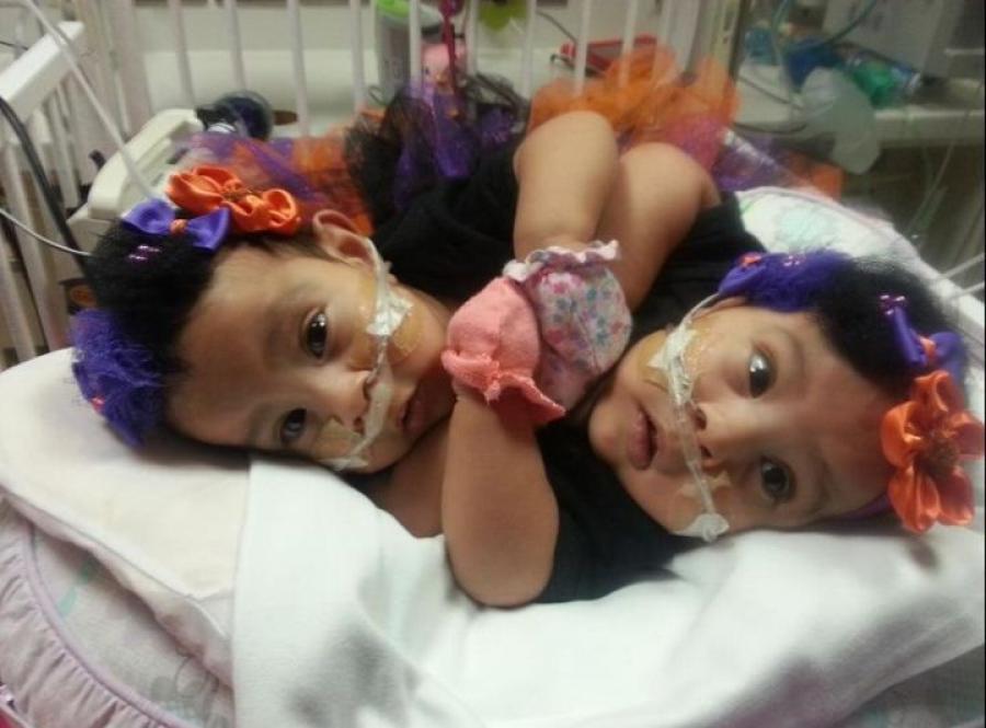 siamoises americaines 1