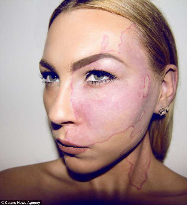 tache de naissance paige billot photo