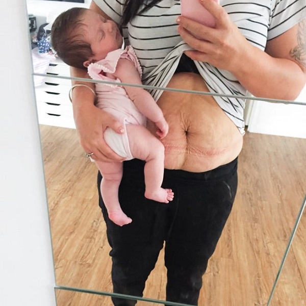 corps post partum apres accouchement