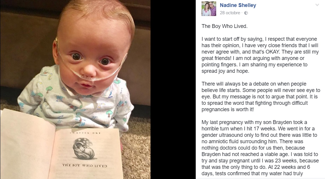 bebe-ne-premature-mere-compare-bebe-harry-potter-post-facebook