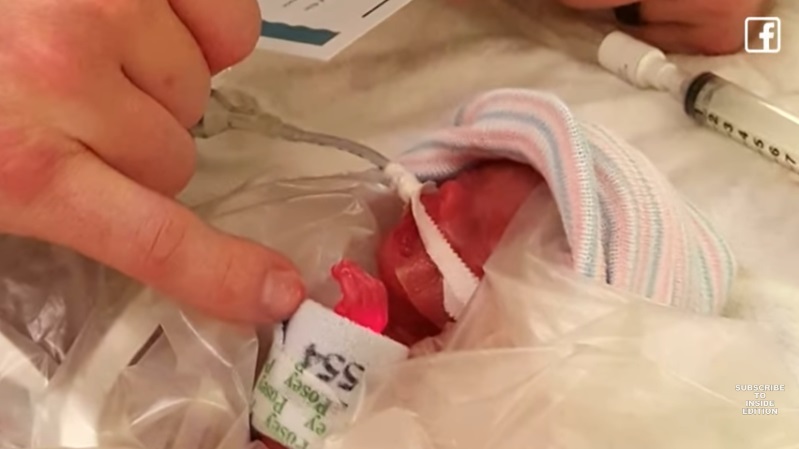 bebe-ne-premature-307-jours-hopital-papa-bebe