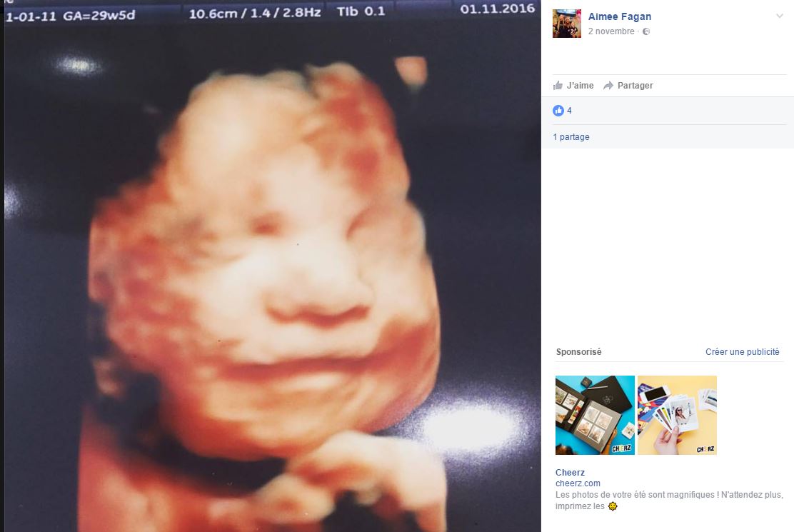 bebe-sourit-durant-echographie-photo-facebook