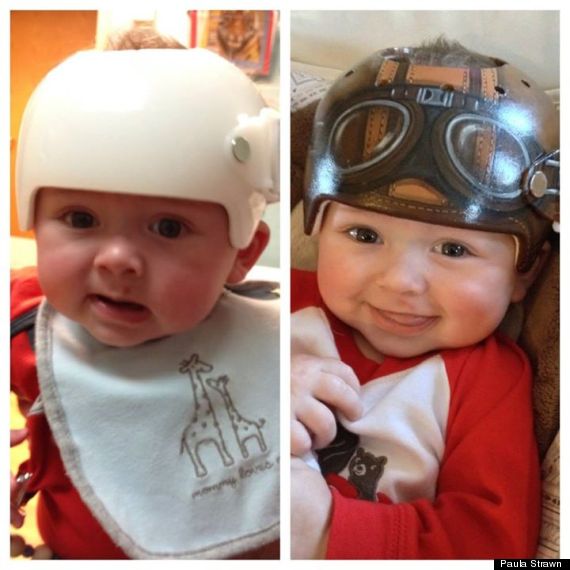paula-strawn-artiste-bebe-syndrome-tete-plate-peint-casque-1