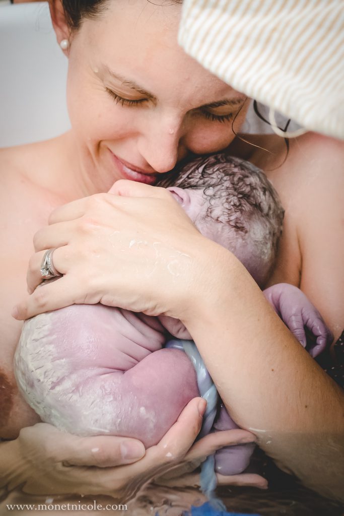 images-of-umbilical-cords