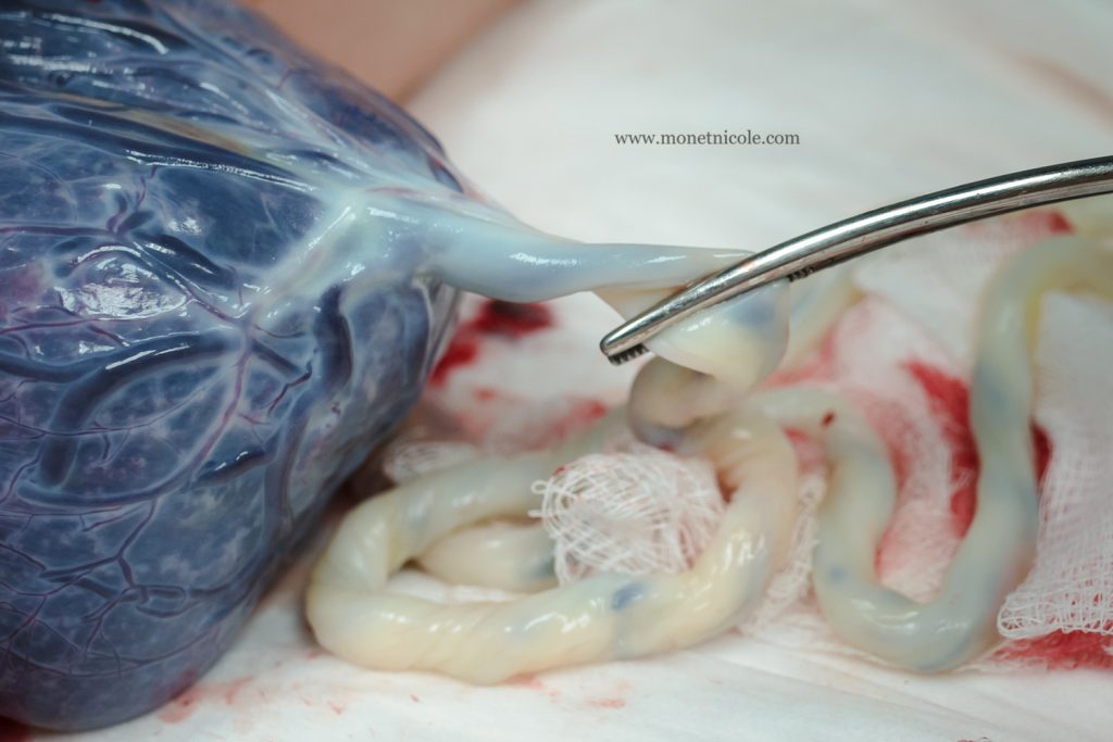 placenta